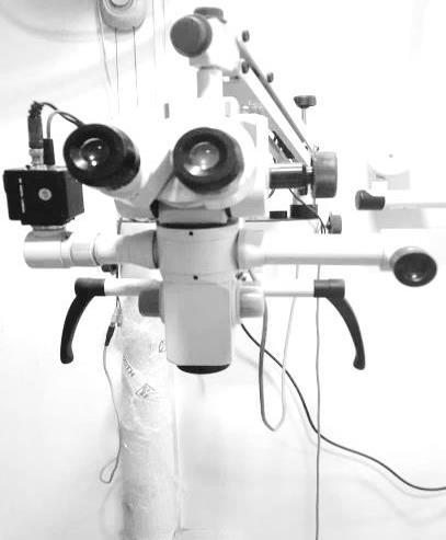 magnification
